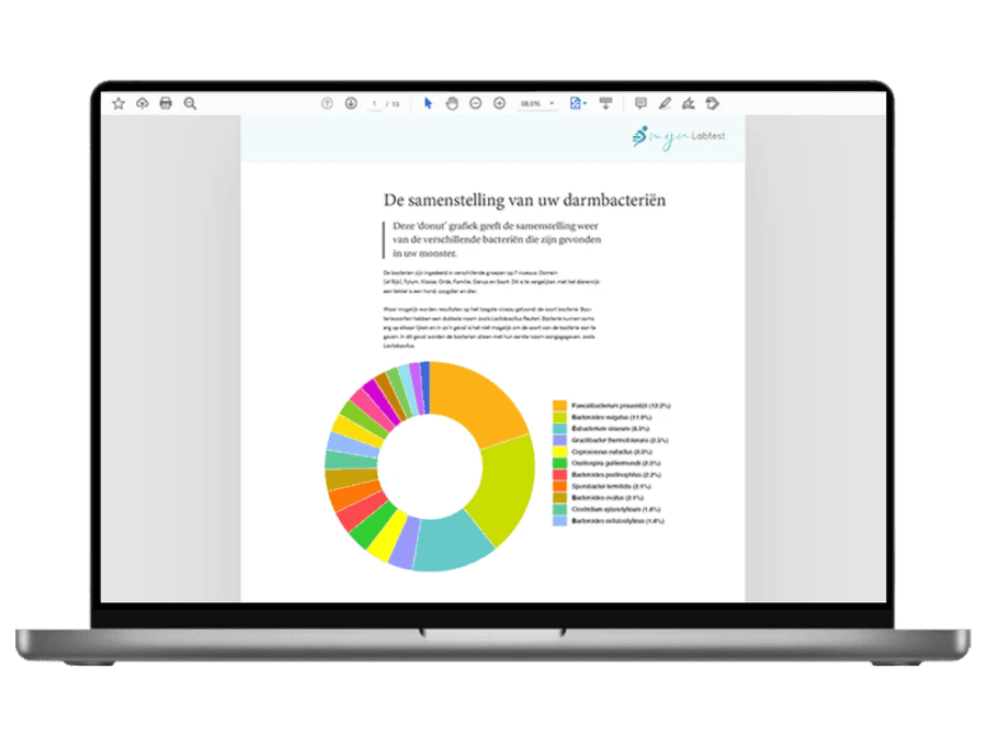 Esempio dei risultati dell'analisi del microbioma XL visualizzati su un laptop