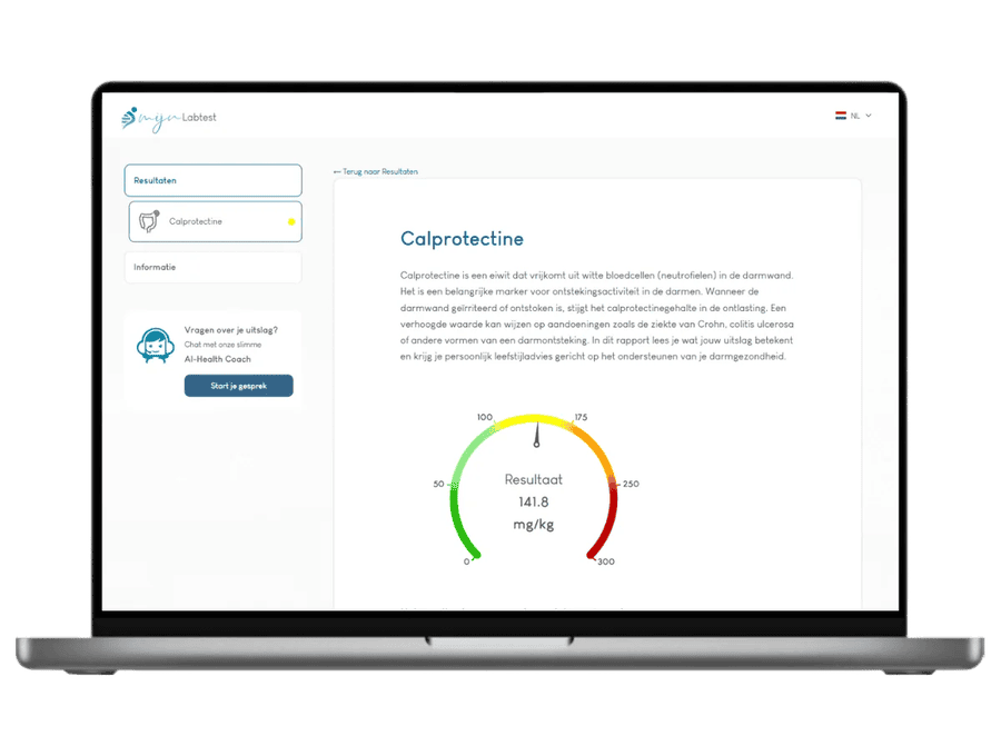 Esempio di risultato del test della calprotectina visualizzato su un laptop