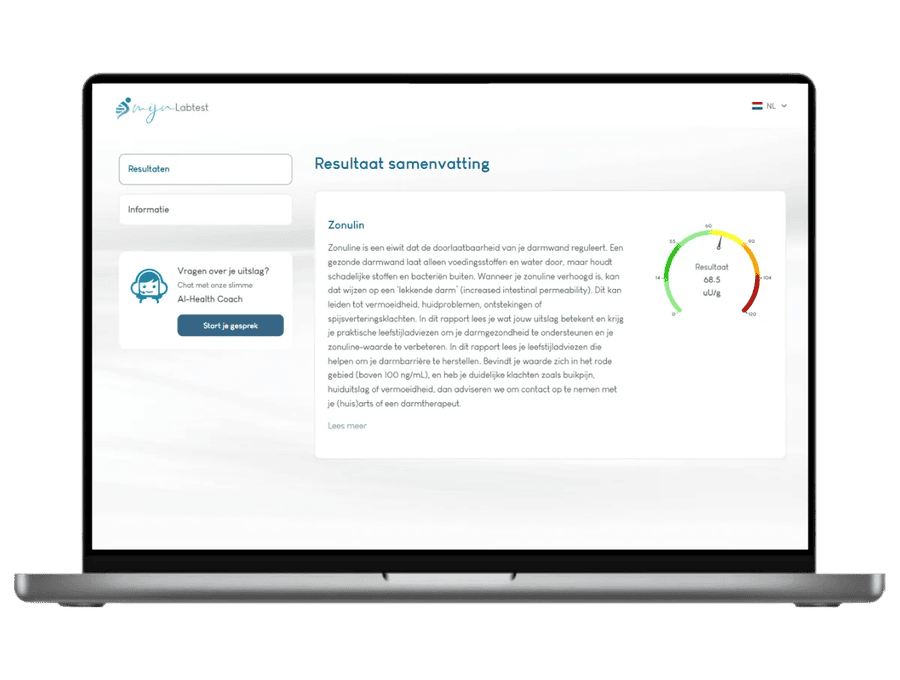 Esempio dei risultati del test Zonuline su un laptop